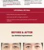 KSECRET - SEOUL 1988 Eye Cream : Retinal Liposome 4% + Fermented Bean